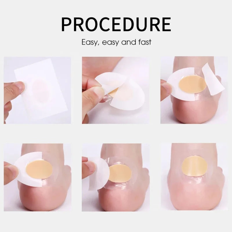 10 à 100 protections de talon en gel, patchs adhésifs pour les pieds, coussinets anti-ampoules, doublures de talon hydrocolloïdes, autocollants pour chaussures, pansements anti-douleur, soins des pieds